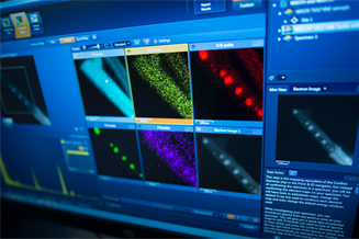 analysis of metal particles by microscopy